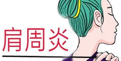 不良習慣為肩周炎埋下伏筆？玄鹿中頻治療儀