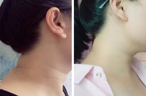 “富貴包”又稱(chēng)”奪命包”-家用治療儀