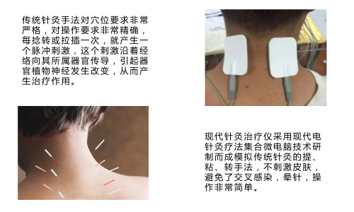 無(wú)痛針灸療法-玄鹿中頻選穴治療儀