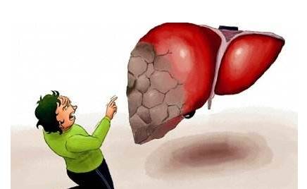 頭部出現(xiàn)這4種狀況，就要注意你的肝了！